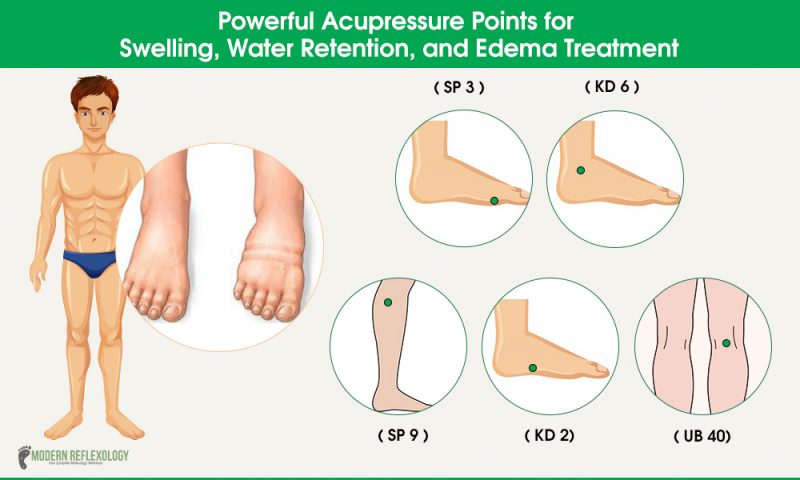 Acupressure Points to Treat Swelling, Water Retention and Edema