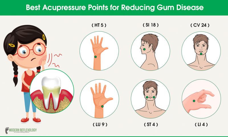 Acupressure Points for Reducing Gum Disease - Modern Reflexology