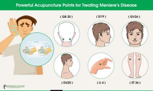 Powerful Ear Acupressure Points to Treat Earache, Ear Infection