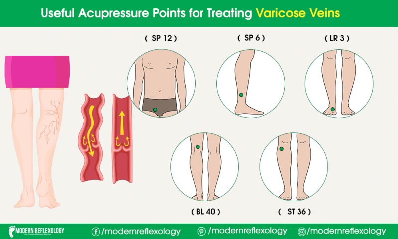 Acupressure Points for Treating Varicose Veins