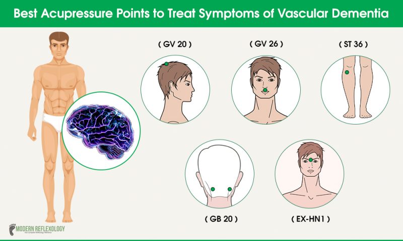 Acupuncture points for vascular dementia symptoms