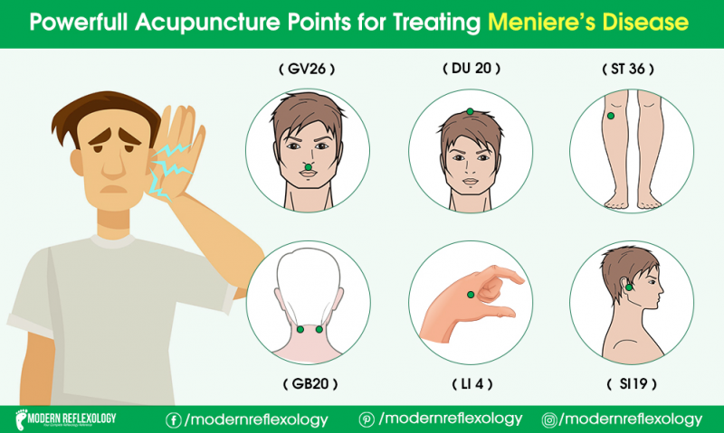 Treating Meniere’s Disease