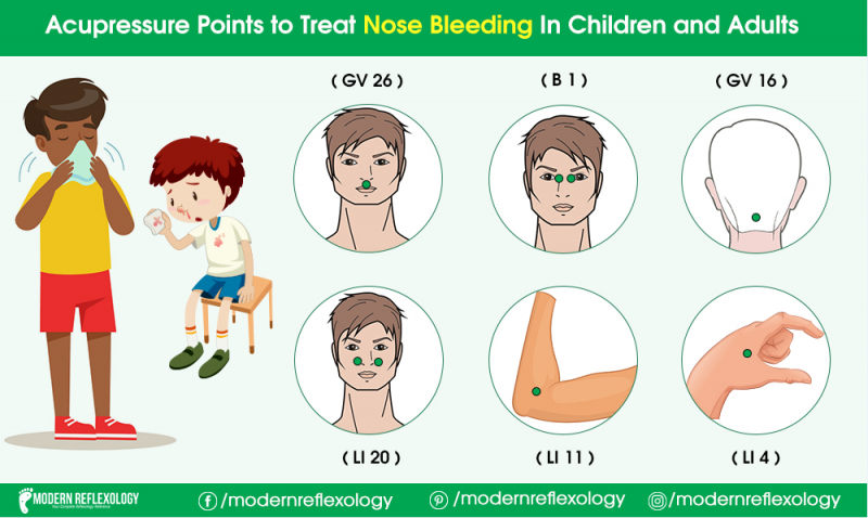 Treat Nose Bleeding