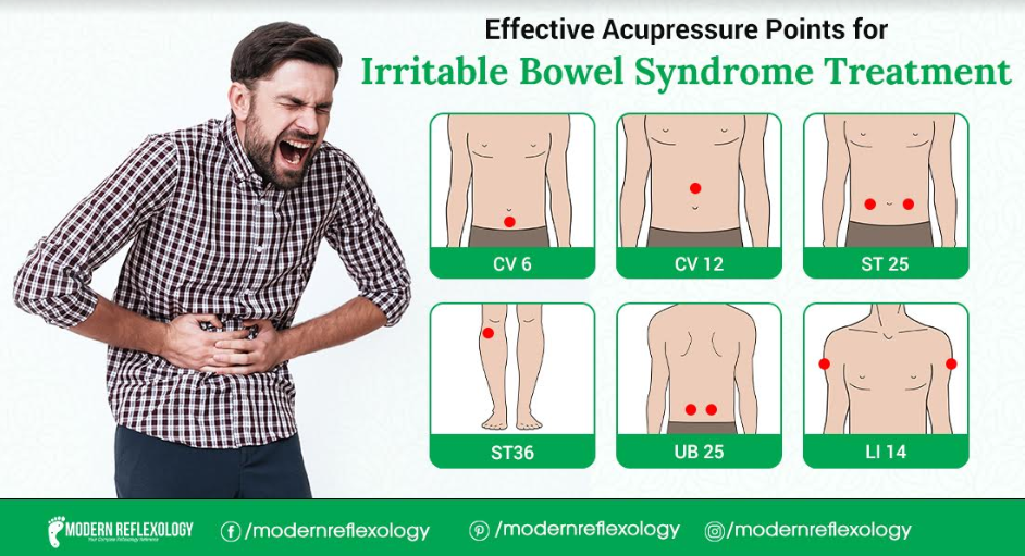 Best Acupuncture Points To Treat Irritable Bowel Syndrome - Modern ...