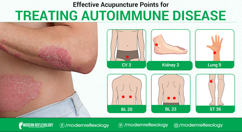 Treat Autoimmune Symptoms