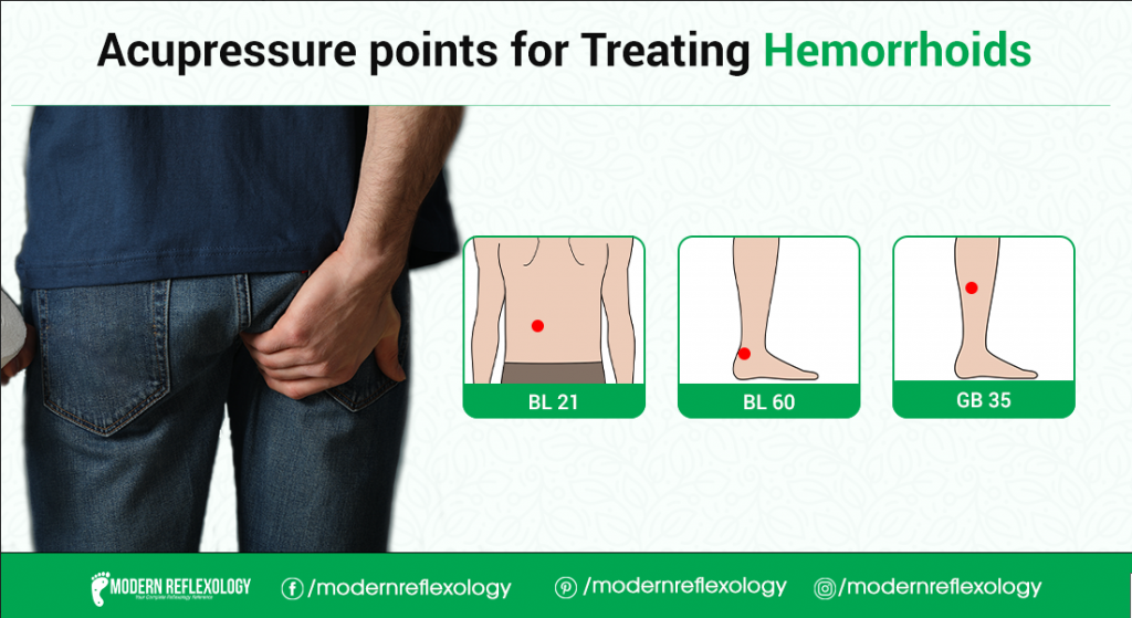 Acupressure Points for Treating Hemorrhoids - Modern Reflexology