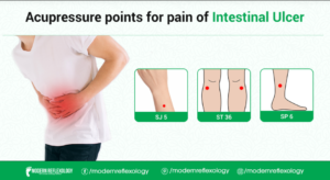 Intestinal Ulcer